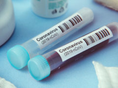 corona-antibodies